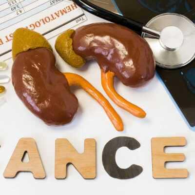 Stages and Diagnosis for Kidney Cancer