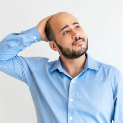 Symptoms and Treatments for Male Pattern Baldness