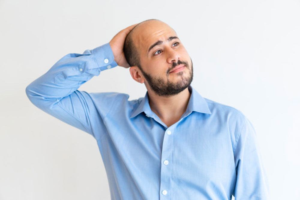Symptoms and Treatments for Male Pattern Baldness